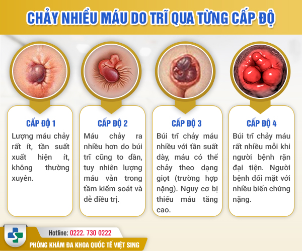 https://www.benhtribacninh.com/wp-content/uploads/2023/05/chay-mau-tri-qua-cap-do.jpg