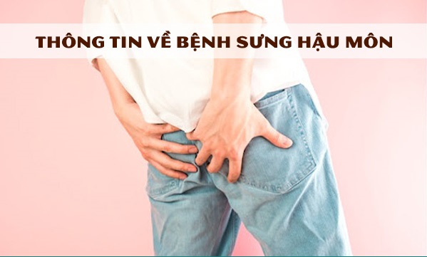 Điểm mặt 8 “thủ phạm” gây sưng hậu môn mà ít ai ngờ tới